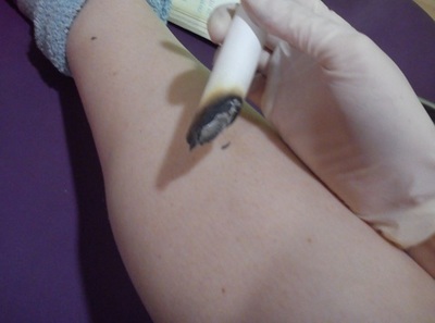 Cesáreas Innecesarias