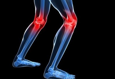 Dolor en la Rodilla